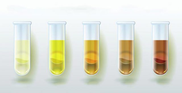 Culoare normală urină - diagramă - Zewa