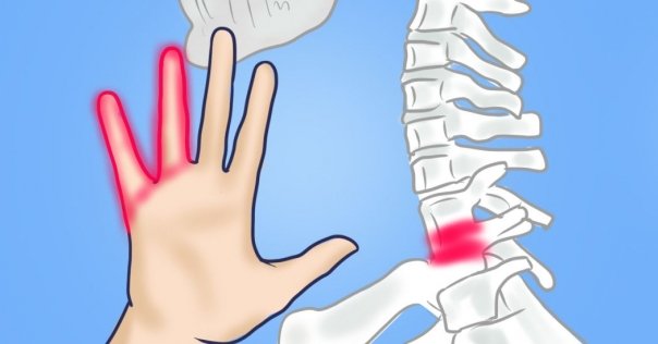 Amorteala mainilor -simptome, cauze si tratament