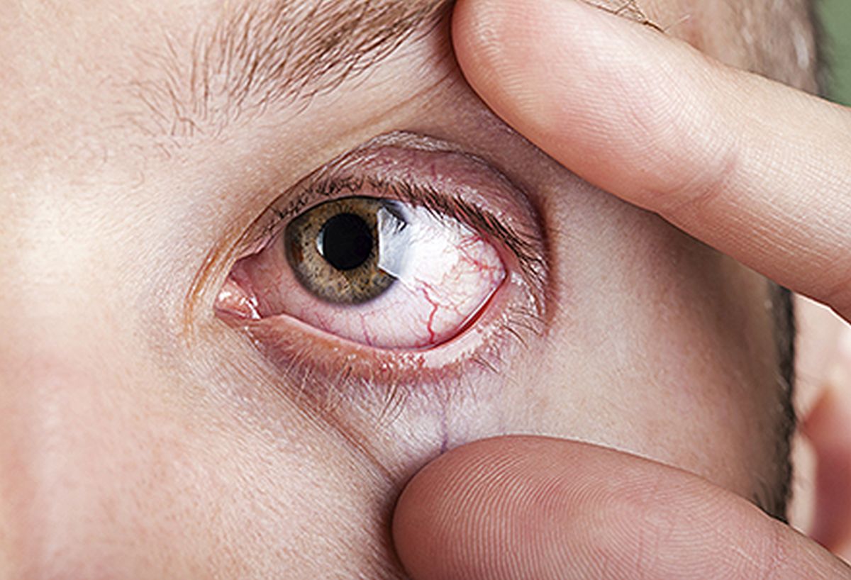 Ce afectiuni poate semnaliza vederea neclara, Vederea a deteriorat oboseala