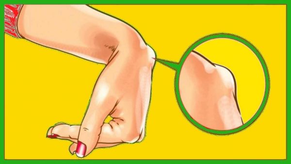 tratamentul ganglionului tendonului la încheietura mâinii