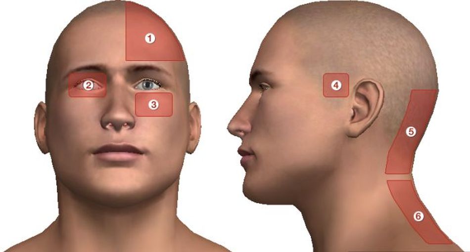 Нос затылок. Левая часть головы. Болит левая сторона головы.