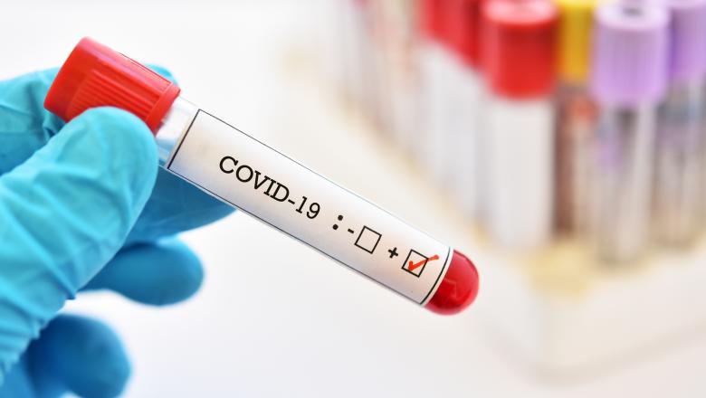 Încă un record al cazurilor de COVID-19 în ultimele 24 de ore în România