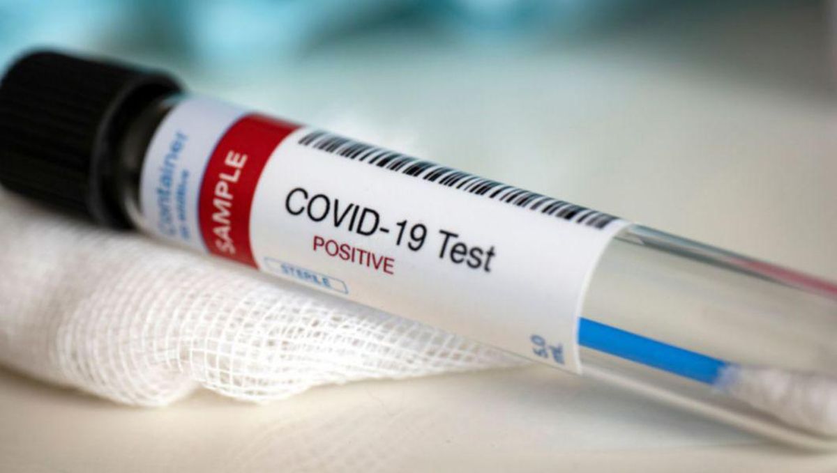 Testele PCR se vând mai ceva ca pâinea caldă în Iași! Laboratoarele private depășesc 1.000 de solicitări pe zi! Ieșenii nu pot face nicio mișcare fără acest test