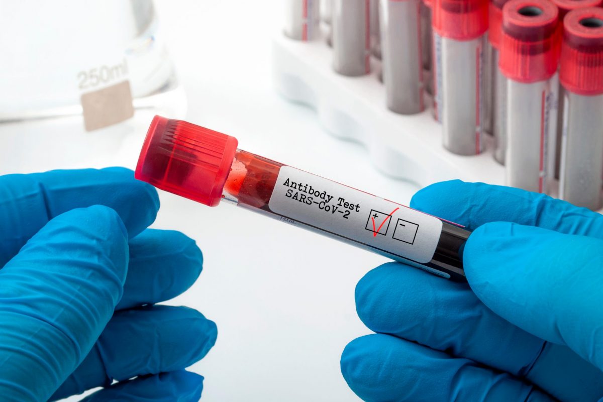 25 persoane, infectate cu noul coronavirus la Centrul Rezidențial Sivomed. Situația Covid-19 la nivelul județului Iași