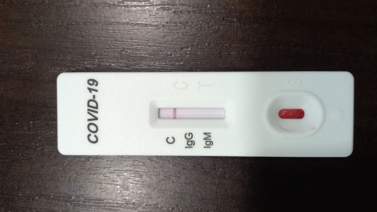 Ministerul Educației anunță posibilitatea ca elevii să folosească testul pentru COVID-19 pe bază de salivă la domiciliu: „Nu este necesară pregătire medicală sau condiții speciale de lucru”