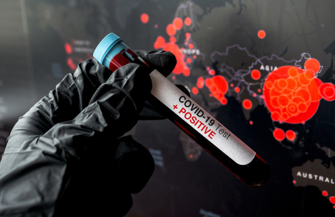 Naţiunile Unite: Anul viitor, o catastrofă umanitară din cauza pandemiei de coronavirus