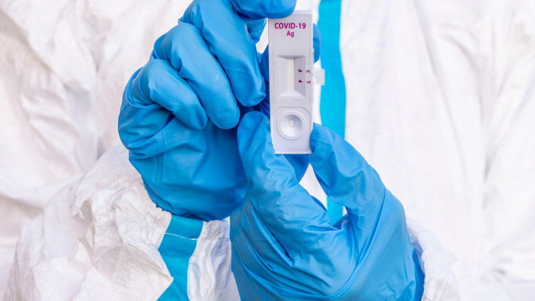 7.365 cazuri noi de persoane infectate cu SARS – CoV – 2 în ultimele 24 de ore