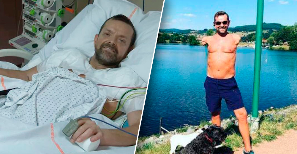 Felix Gretarsson, primul pacient care a suferit un dublu transplant de membre superioare şi de umeri – Video