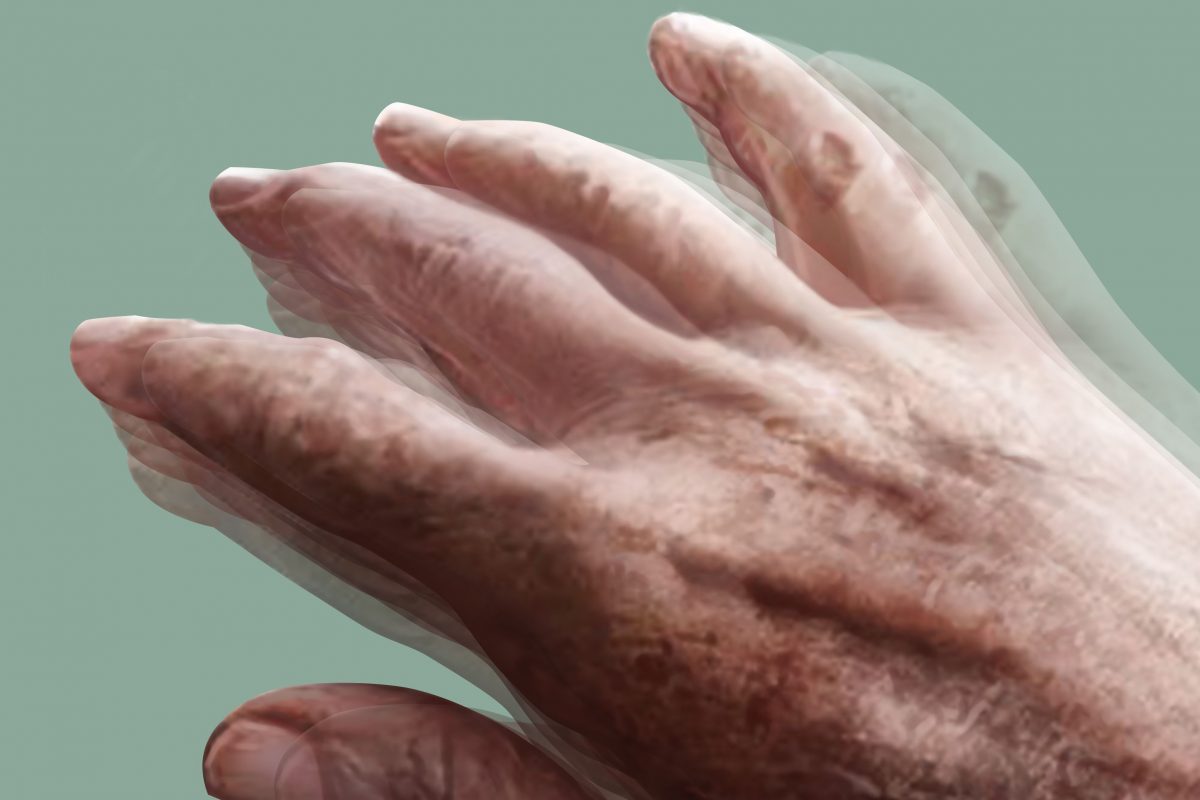 Schizofrenia, un factor de risc pentru boala Parkinson