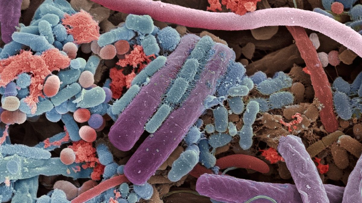 Covid-19: microbiota determina gradul de severitate al bolii