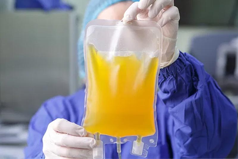 Răsturnare de situație! Plasma nu aduce niciun beneficiu pacienților cu forme grave de COVID-19 – STUDIU