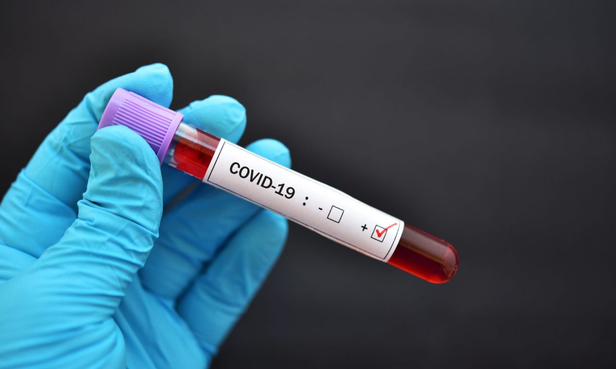 Doar 39 de noi îmbolnăviri de COVID-19 în județul Iași în ultimele 24 de ore