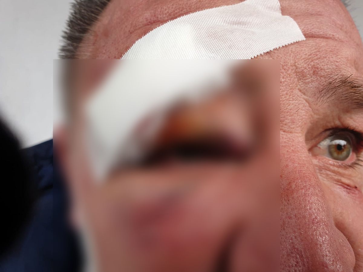 Un notar din Timişoara, bătut crunt pentru că practică cele mai mari prețuri din oraş