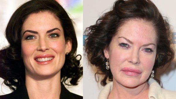 Lara Flynn Boyle este de nerecunoscut. Actrița este transformată total din cauza operațiilor estetice