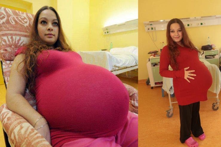 40 de medici au asistat-o la naştere. Câţi copii a putut să nască