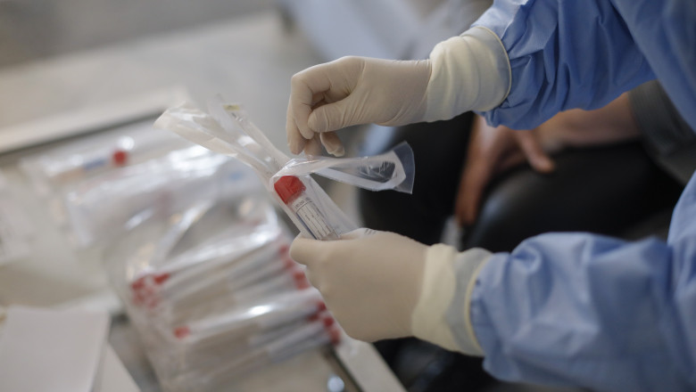 1.872 cazuri noi de persoane infectate cu SARS – CoV – 2 în ultimele 24 de ore în România
