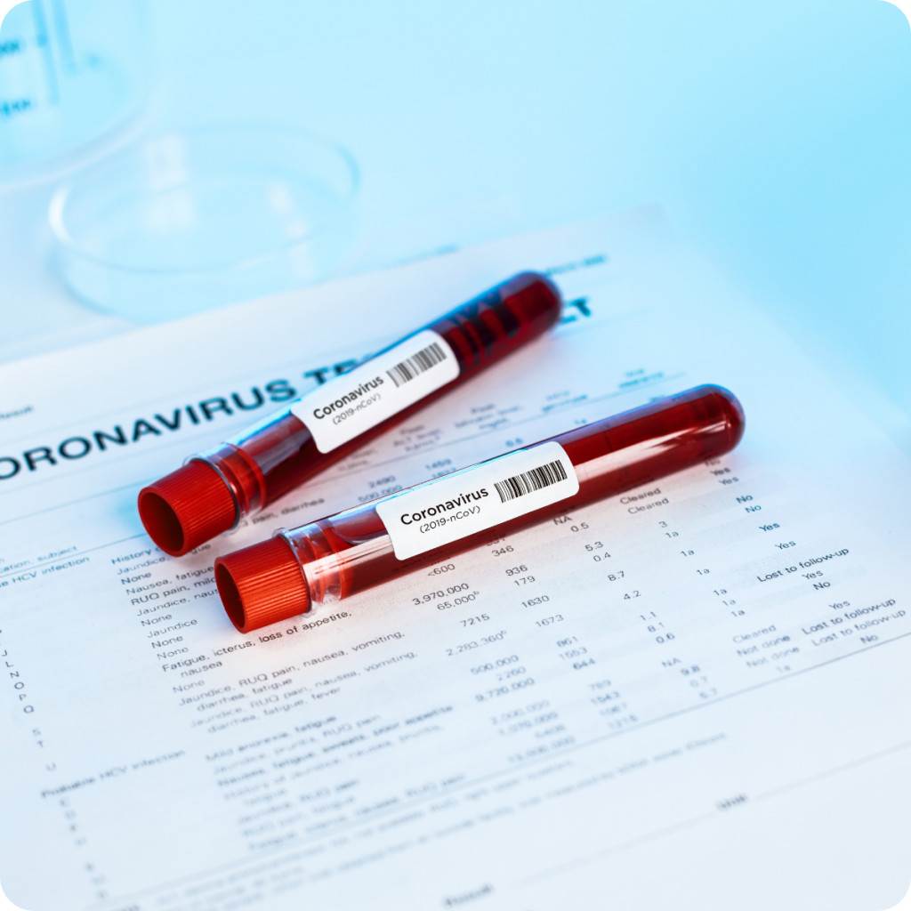 Un nou test rapid pentru detectarea anticorpilor la coronavirus