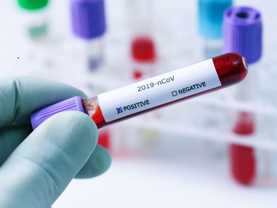 Este posibil să te îmbolnăvești de două ori de COVID-19, iar severitatea să fie diferită, avertizează medicii