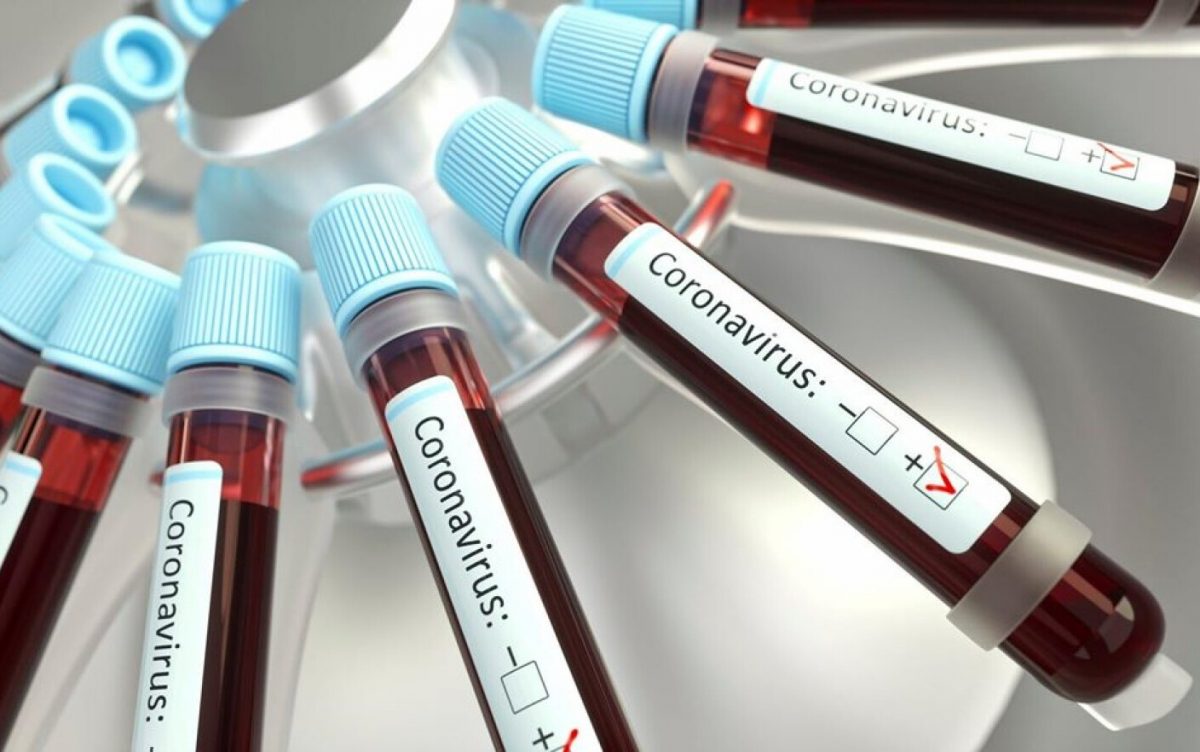 „Co-infecția” cu Covid-19: fenomenul îngrijorător care apare din cauza noilor variante