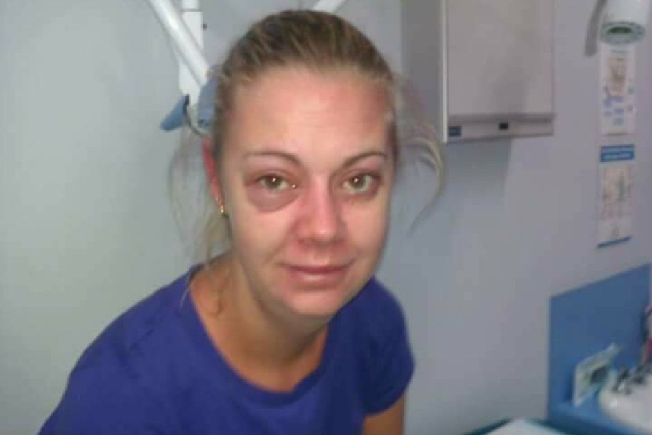 Cum arată o femeie după ce a renunțat la alcool. Obișnuia să bea 12 beri și un litru de vodkă în fiecare zi
