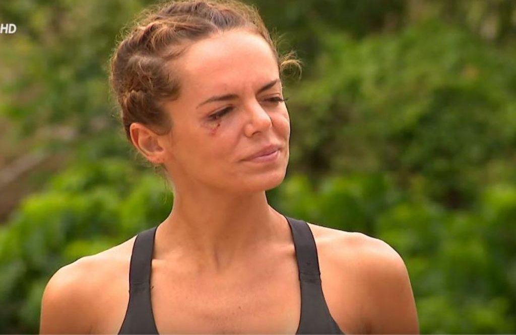 Simona Hapciuc are probleme de sănătate. Sângerări nazale și dureri de cap după întoarcerea de la Survivor