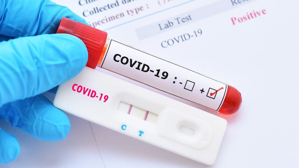 2.280 cazuri noi de infectare cu noul coronavirus, astăzi, în România. Situația Covid-19 pe județe