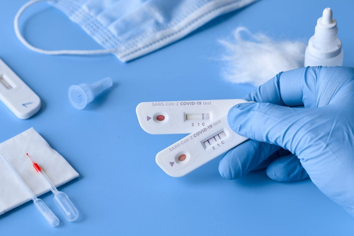 Preţul testelor de anticorpi Covid poate ajunge și la 200 de lei, în România