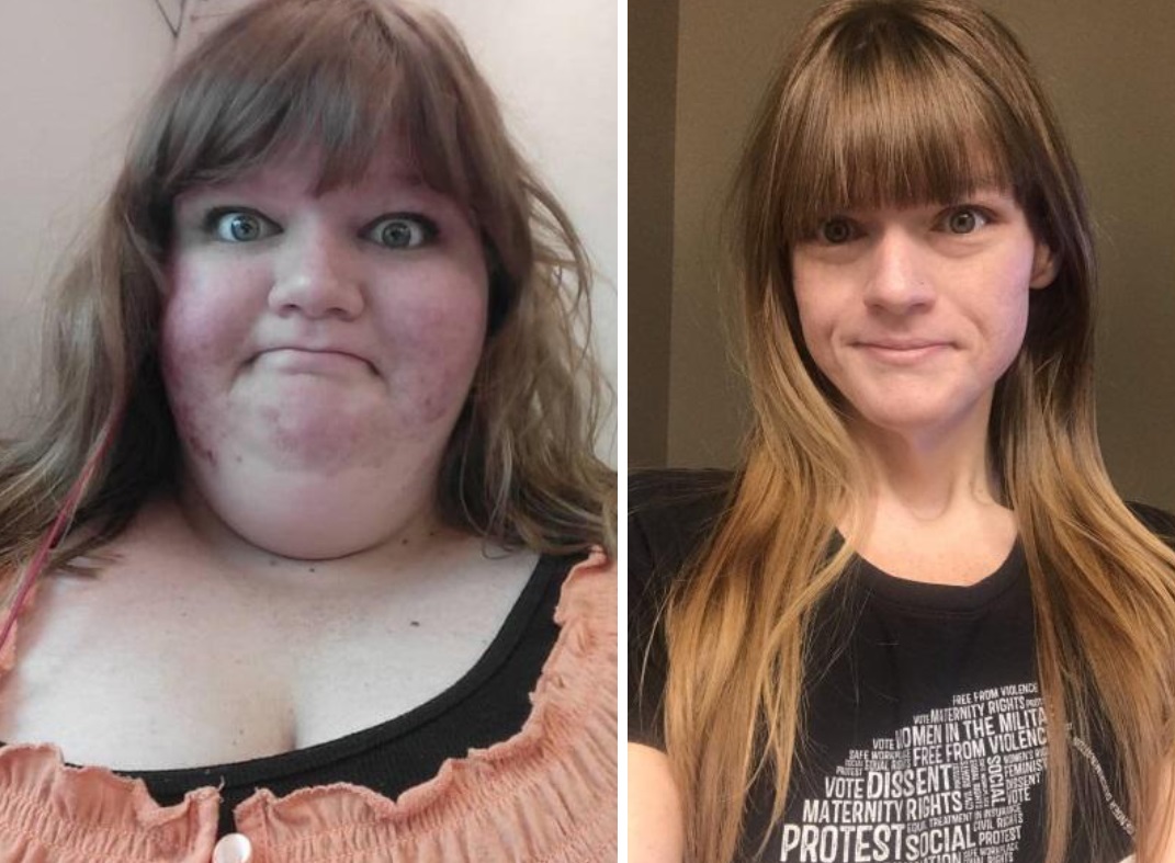 A slăbit 125 kg renunțând la un singur aliment. Transformare uluitoare