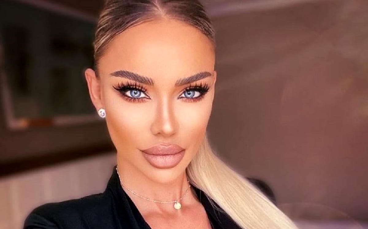 Ce a pățit Bianca Drăgușanu la ochi. A apărut așa la o petrecere mondenă
