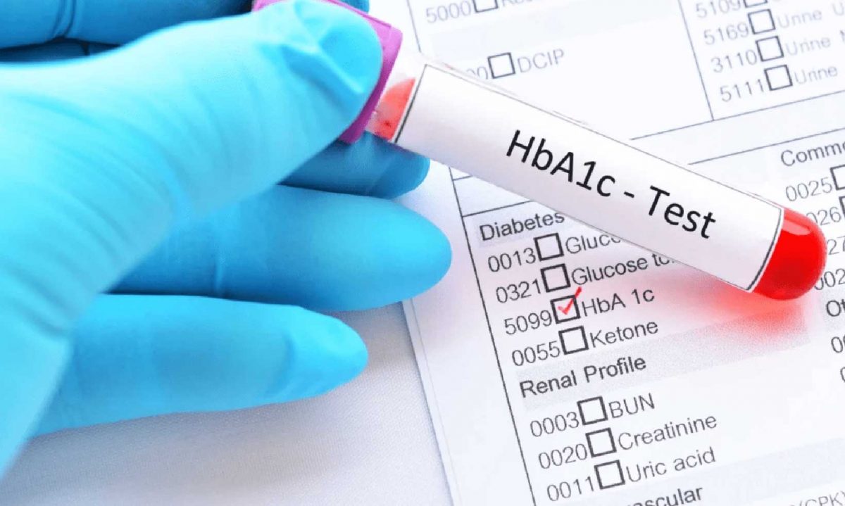 Testul hemoglobinei: niveluri normale, ridicate, scazute
