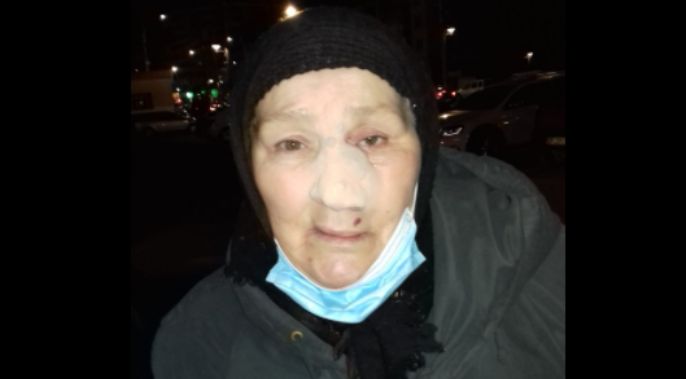 Povestea unei bătrâne domiciliată in Brăila și care suferă de o tumoare la nivelul feței