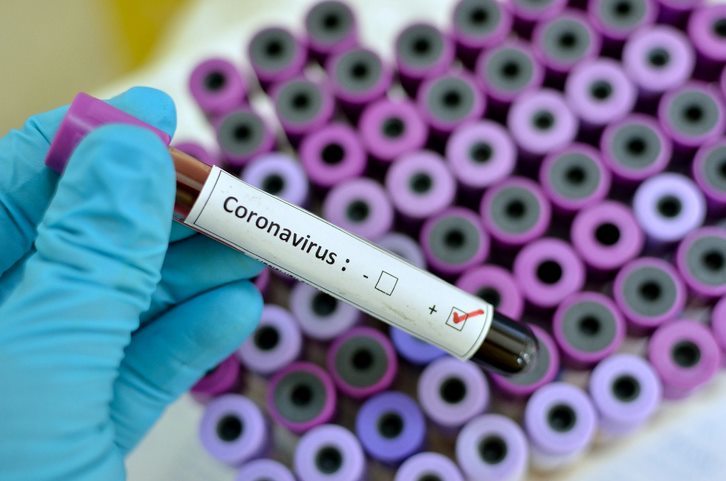 Bilanț coronavirus 23 iunie: 66 cazuri noi de persoane infectate cu SARS – CoV – 2, în ultimele 24 de ore, în România