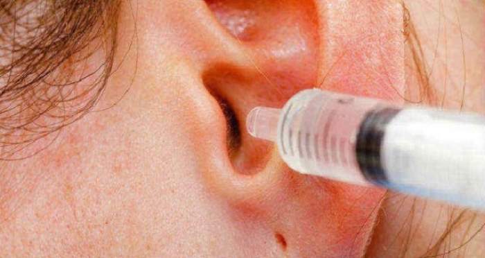 Cu ce se scoate dopul de ceară ureche: Câteva soluții pe care le recomandă medicii de ORL