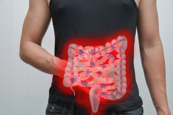 Bicarbonat de sodiu pentru viermi intestinali: Remediu natural pentru curățarea organismului