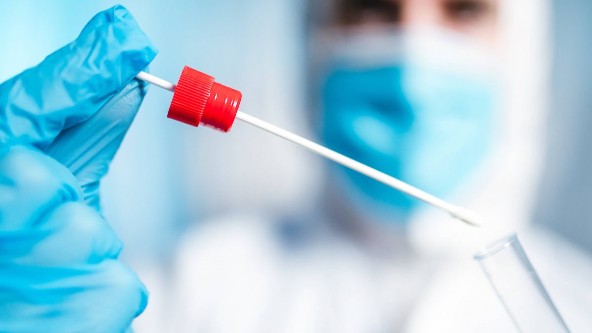 Veste șocantă! CDC al SUA renunță la metoda de diagnosticare a coronavirusului prin testele RT-PCR