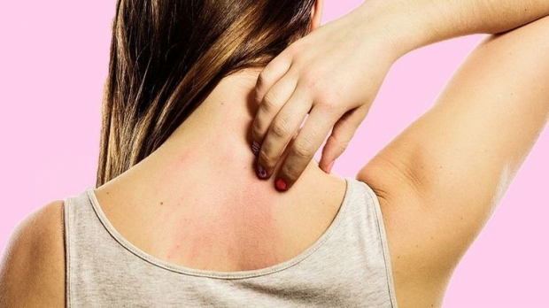 Care sunt cele mai frecvente cauze ale mâncărimii de piele? Iată explicațiile unui medic dermatolog