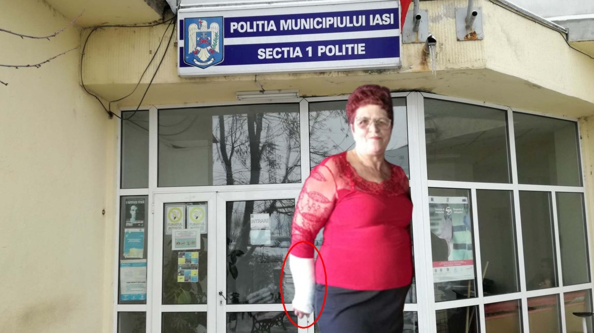 Toată baza în polițiștii din Iași! O femeie a fost bătută în Piața Voievozilor, iar de un an se roagă de oamenii legii să i se facă dreptate: "Mi-a rupt mâna, am avut 65 de zile de îngrijiri medicale și nimeni nu face nimic" - Vimarsana News