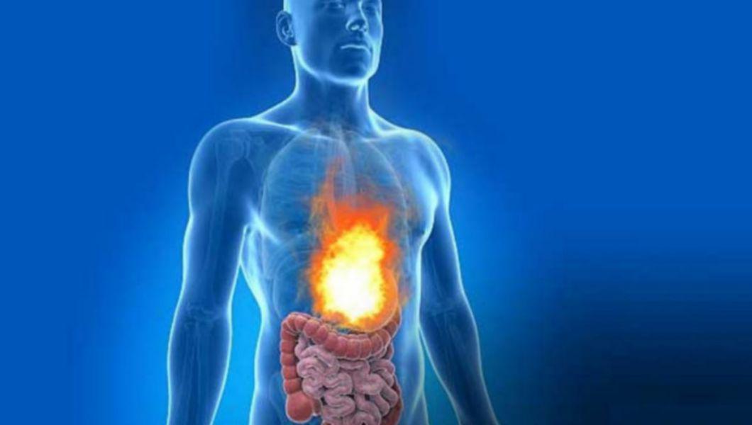 Medicamente care scad aciditatea gastrică: Cum te pot ajuta antacidele