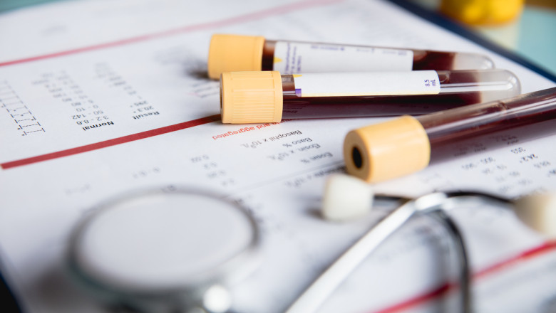 Ce analize trebuie făcute pentru ficat: Așa îți dai seama dacă ai probleme hepatice