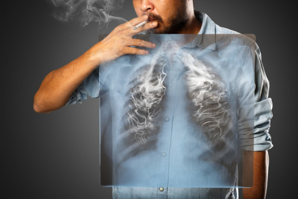 Cancer la plămâni: Cum îți dai seama că te-ai îmbolnăvi