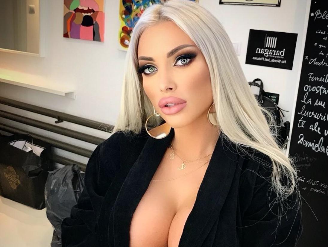 Loredana Chivu: Înălțime și aspect de păpușă după o serie de operații estetice
