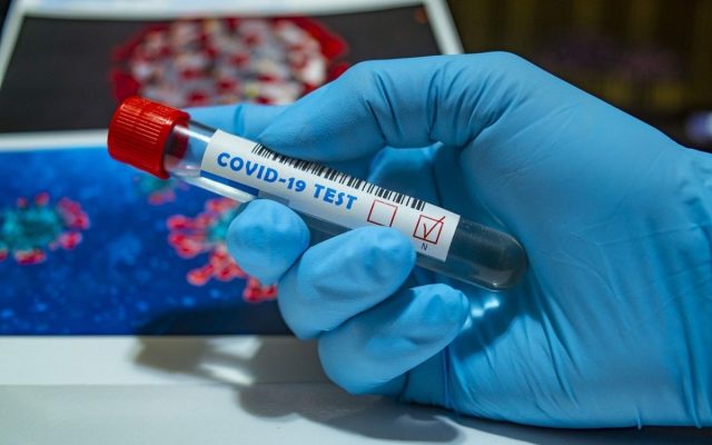 2.736 de cazuri noi de persoane infectate cu SARS – CoV – 2 și 273 de decese, înregistrate în ultimele 24 de ore, în România