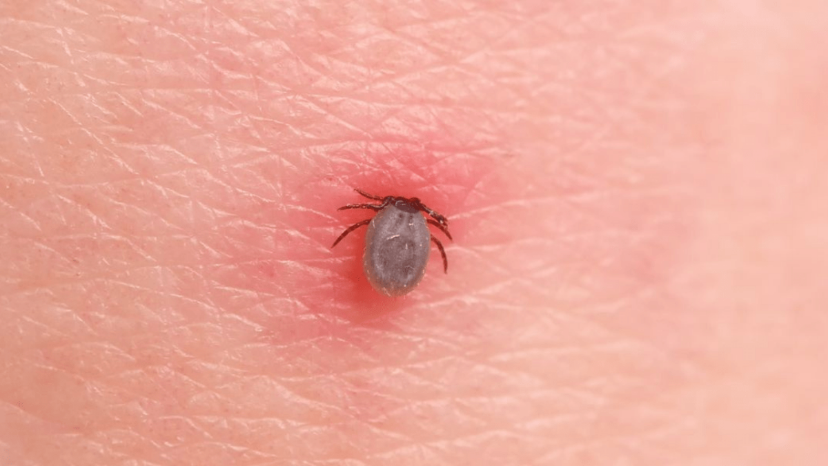 Trebuie să iau antibiotic dacă m-a mușcat o căpușă? Află totul despre mușcătura de căpușă