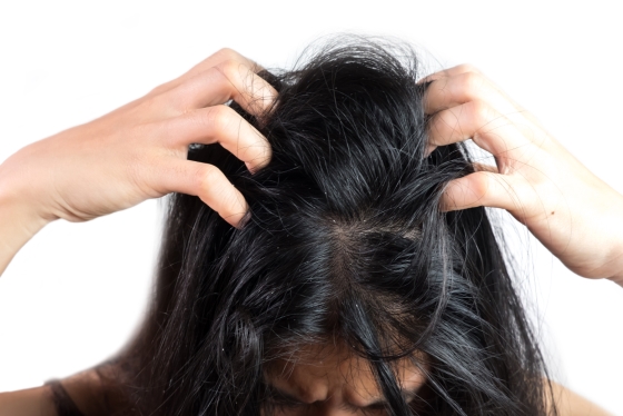 Dermatită seboreică scalp: Tratamentul recomandat de specialiști