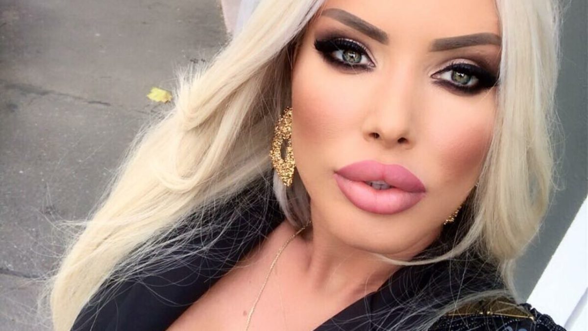 Loredana Chivu a ajuns din nou pe mâna medicilor. Și-a făcut fosta prezentatoare o nouă operație estetică?
