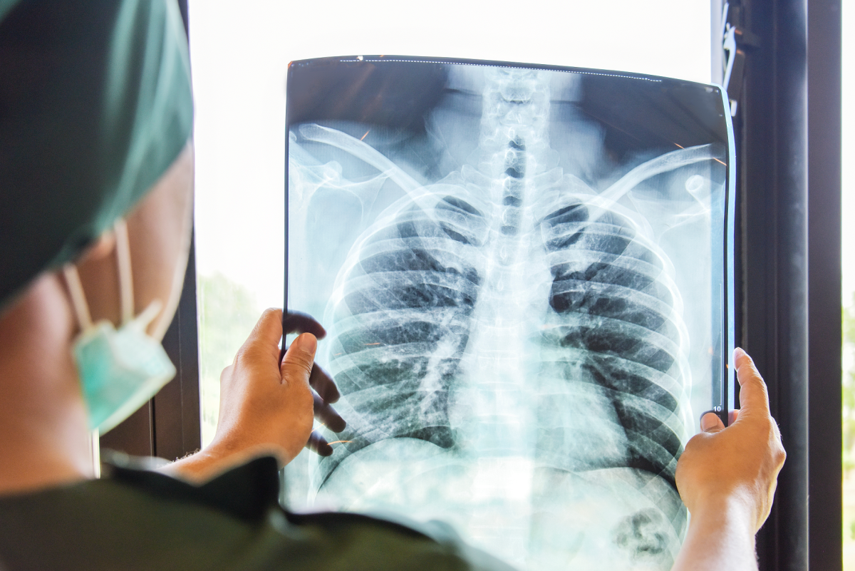 Peste 1.000 de oameni din județul Suceava suferă de infecții acute ale căilor respiratorii și pneumonii