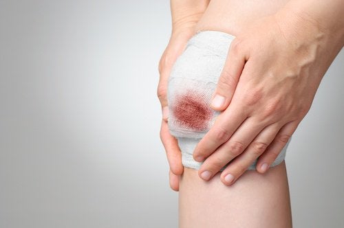 Unguent cu antibiotic pentru răni deschise: Ce trebuie să știți despre procesul de vindecare