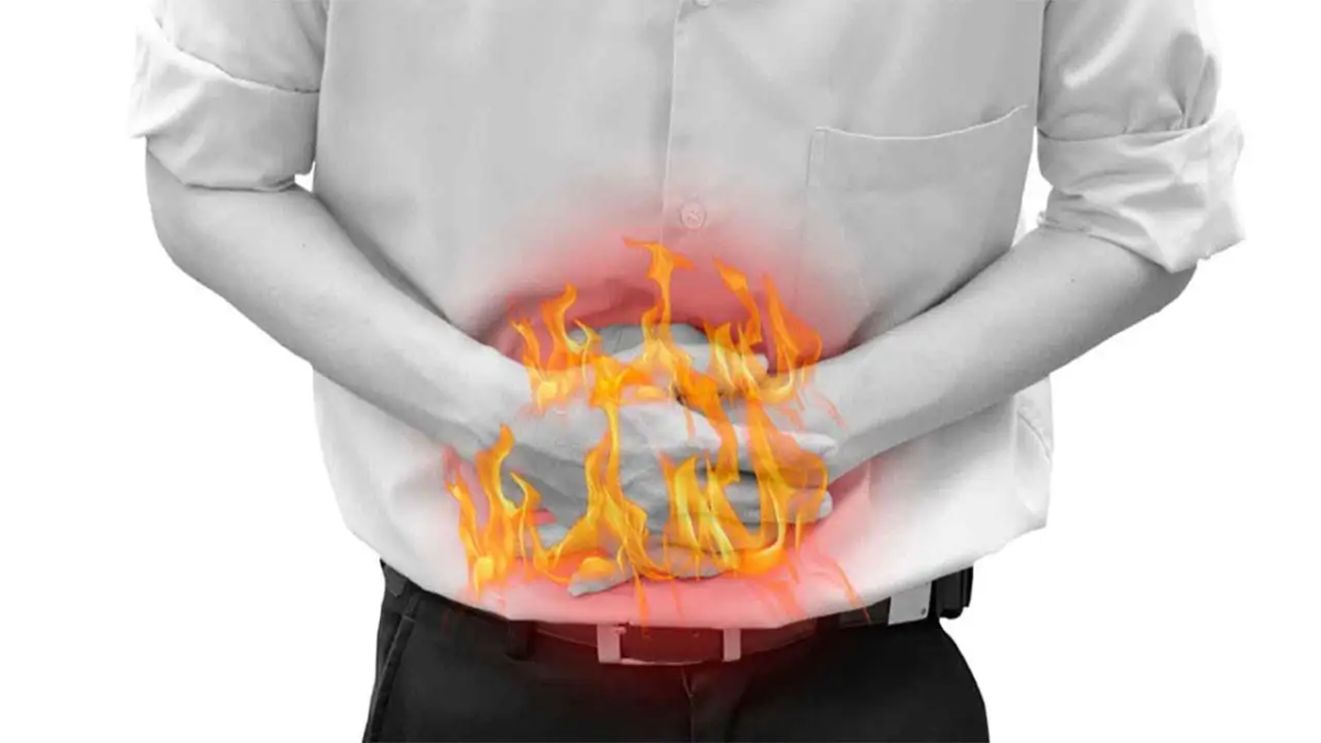 Arsuri la stomac: Din ce cauză apar arsurile?