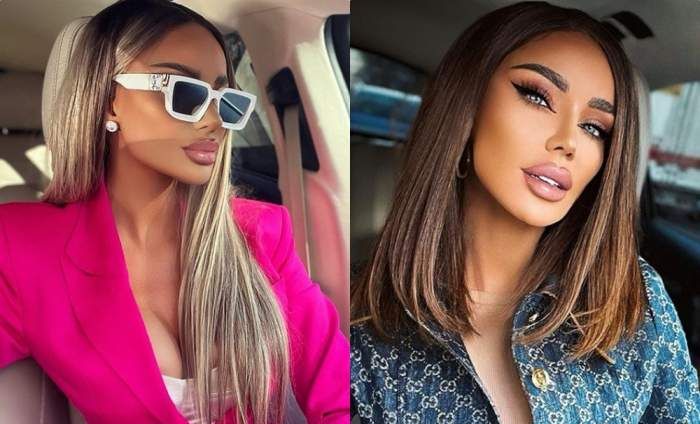 Bianca Drăgușanu și-a injectat din nou buzele. Ce altă intervenție și-a mai făcut vedeta