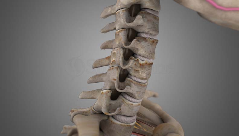 Exerciții pentru spondiloză cervicală. Sfatul medicilor